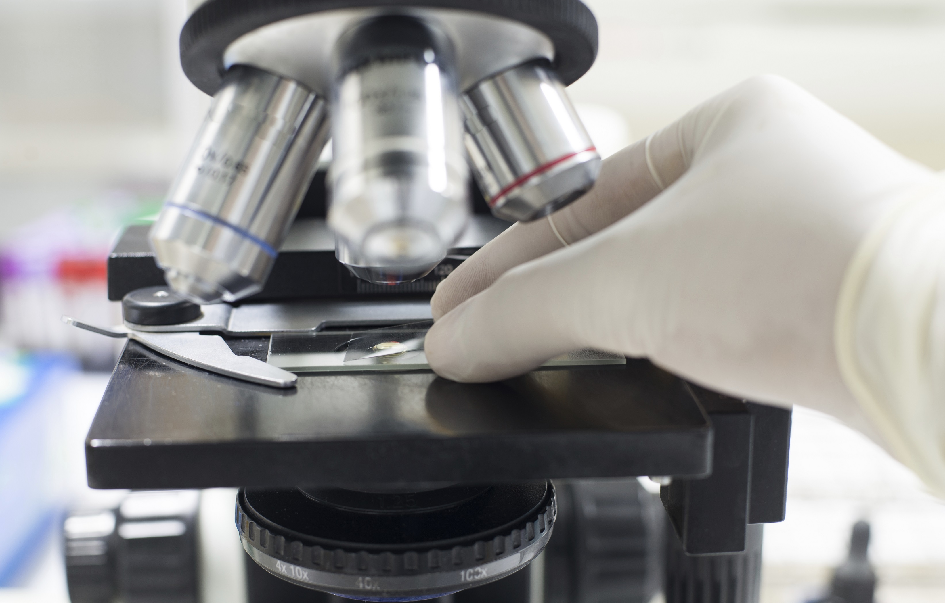 Ricerca Scientifica sui Linfomi